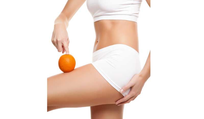 ¿Las mujeres deportistas pueden tener celulitis?