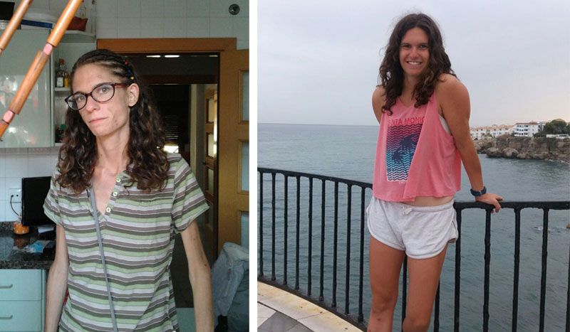 Cuando el reto es ganar peso para ganar salud, la historia de Teresa Velasco