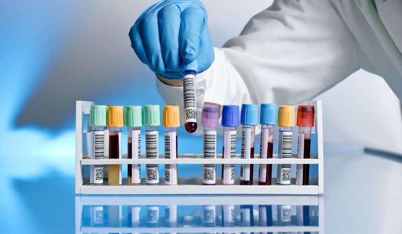 Cómo interpretar tu análisis de sangre, valores y significado
