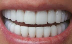 ¿Cómo afecta a tus dientes la dieta Dukan?