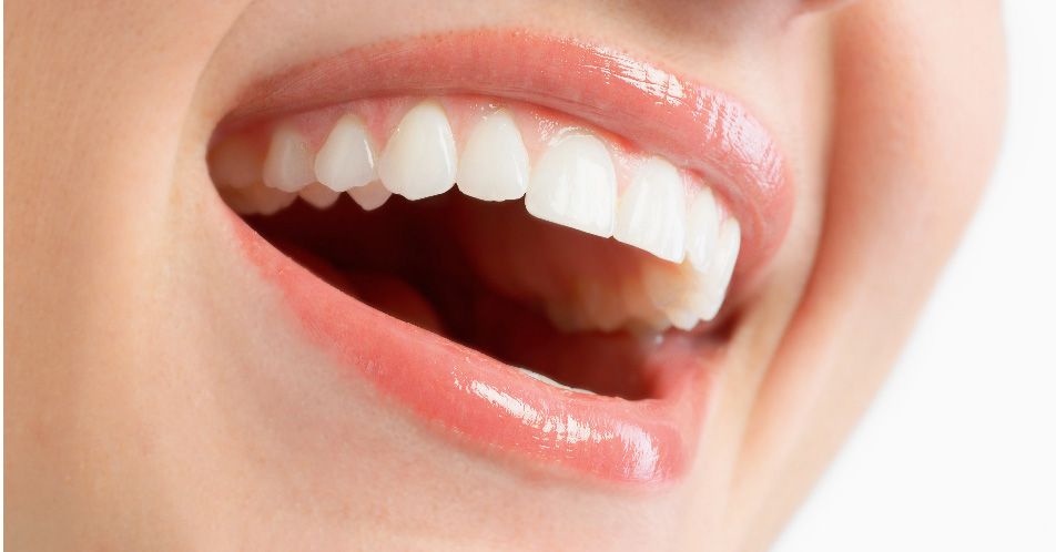 Los “males” del deportista que no cuida sus dientes