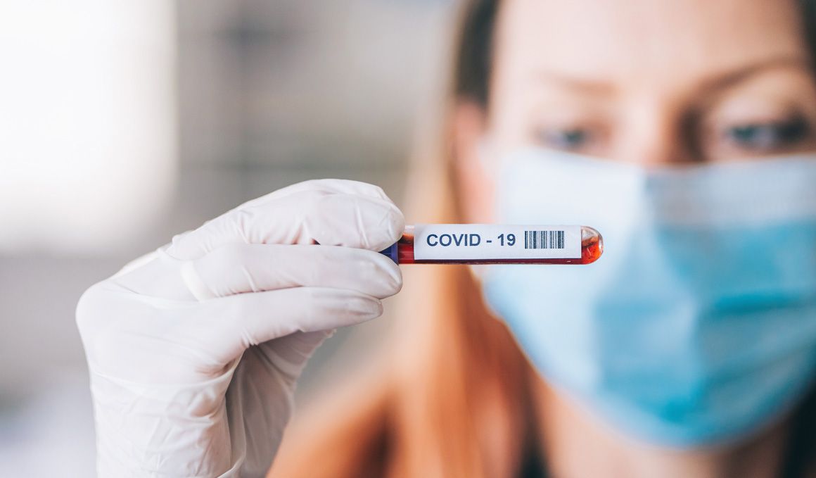 Todo lo que querías saber sobre el test Covid-19