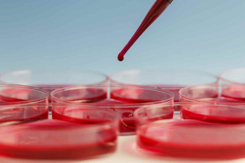 ¿Es el hematocrito realmente un valor que indica nuestra forma física?