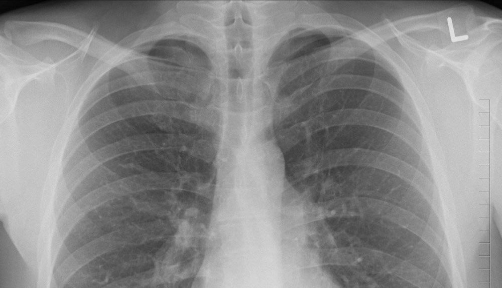diagnosis 1476620 1280 diagnosis 1476620 1280