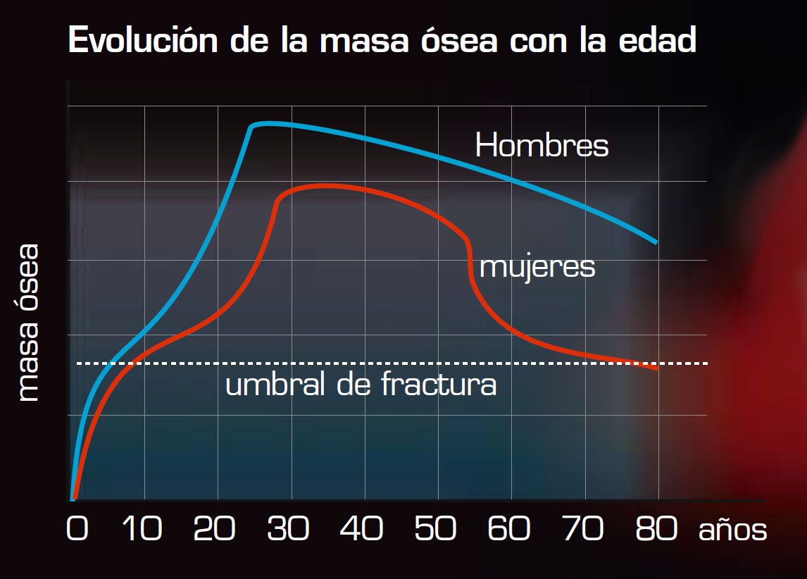 Masa ósea edad