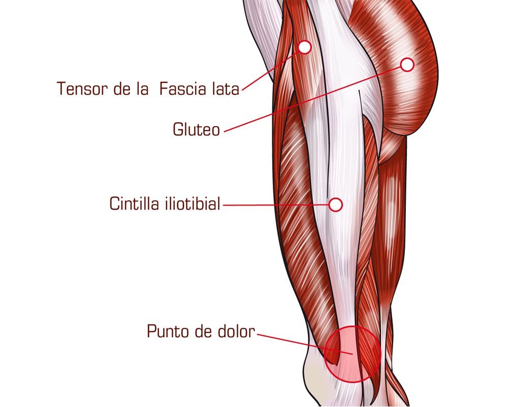 Cintilla iliotibial Cintilla iliotibial