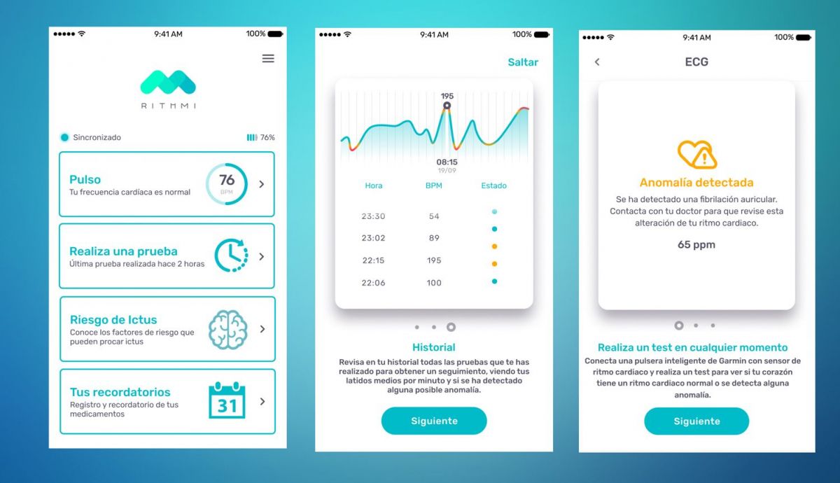 rithmi app ictus fibrilacion rithmi app ictus fibrilacion