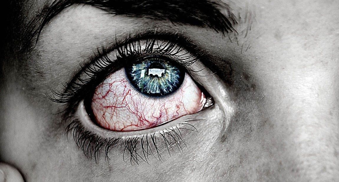 Frotarse los ojos (3) Frotarse los ojos (3)