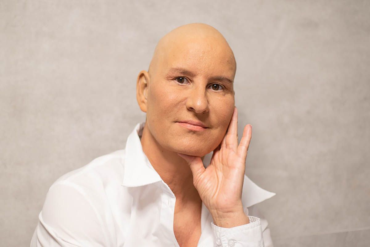 Otro cancer Otro cancer