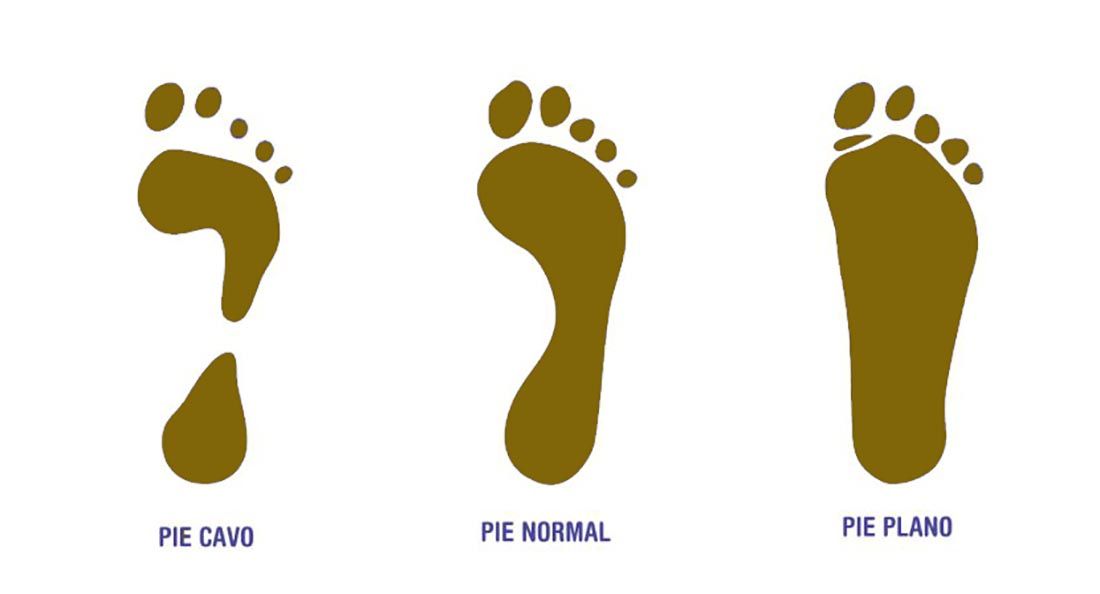 Cavo normal y plano Cavo normal y plano