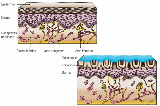 Dermis kinesiotape