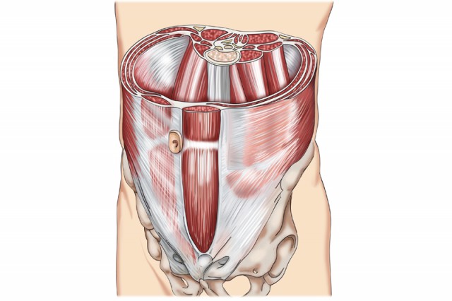 Transversal abdominales