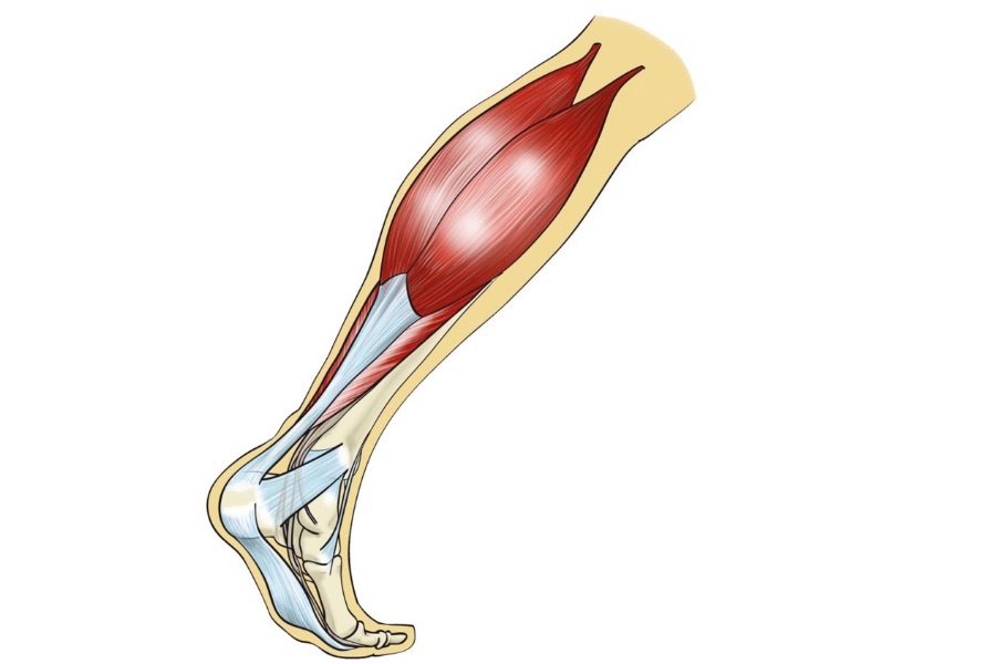 Stiffness, rigidez muscular positiva