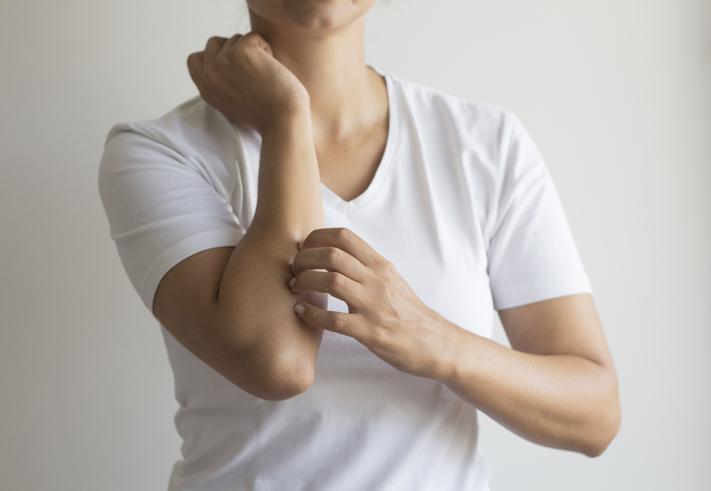 Dermatitis atópica, ¿qué es y cómo podemos tratarla?