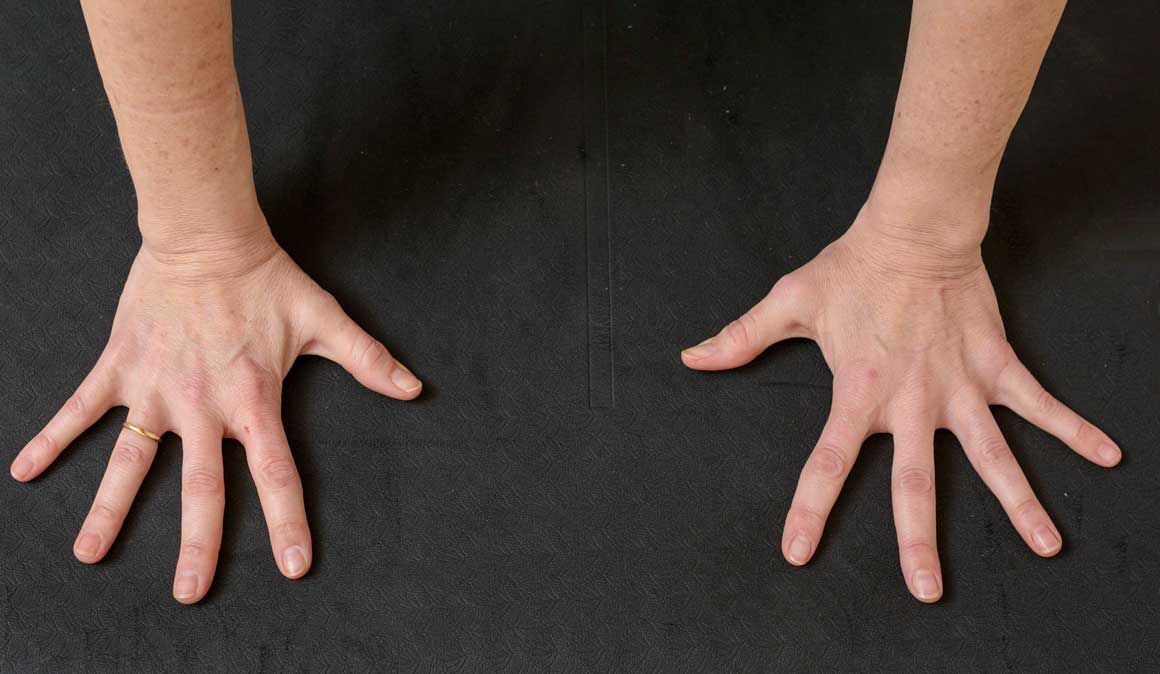 Como evitar el dolor de muñecas en la práctica de yoga