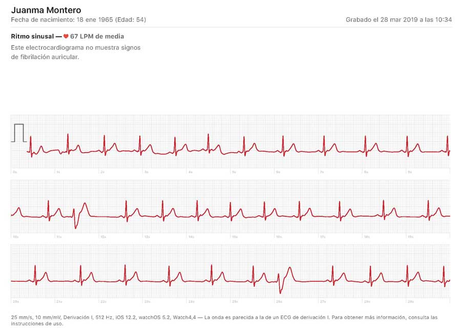 Ya te puedes hacer un electrocardiograma con tu Apple Watch