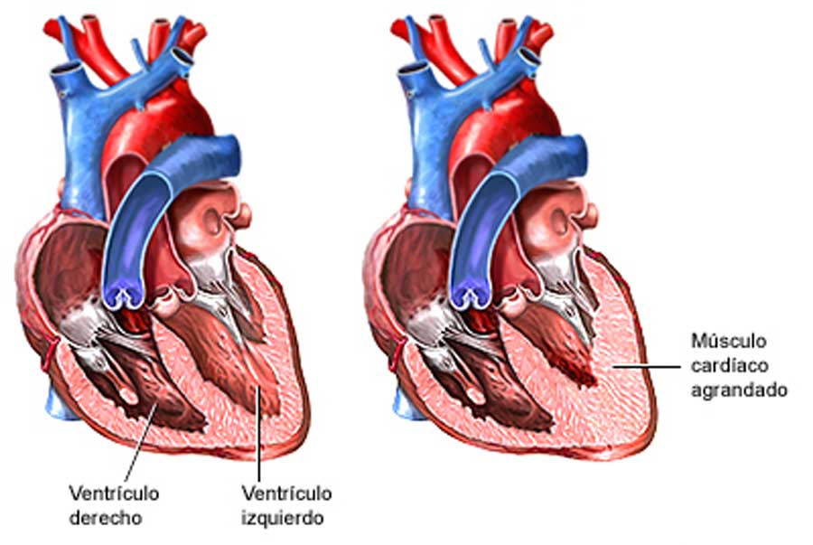 ¿Es mejor tener un corazón fino o grueso?