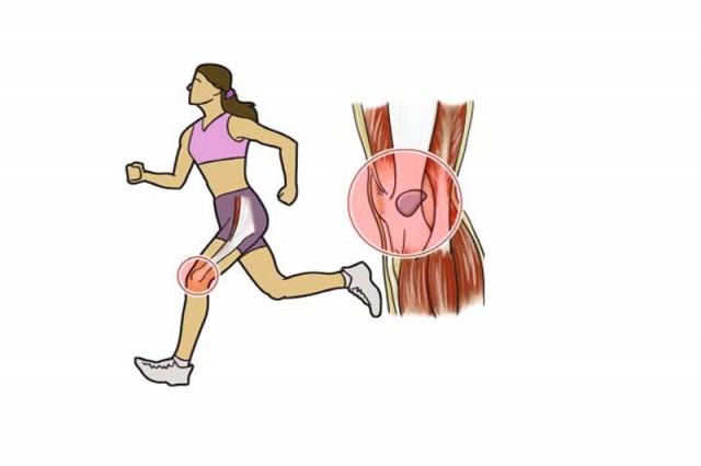 ¡No dejes que te atrapen las lesiones!