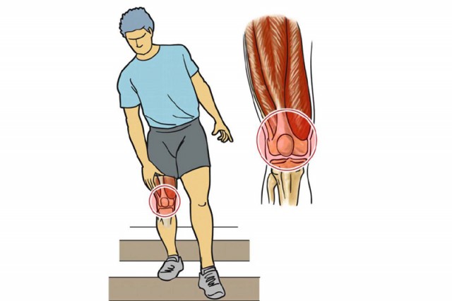 ¡No dejes que te atrapen las lesiones!