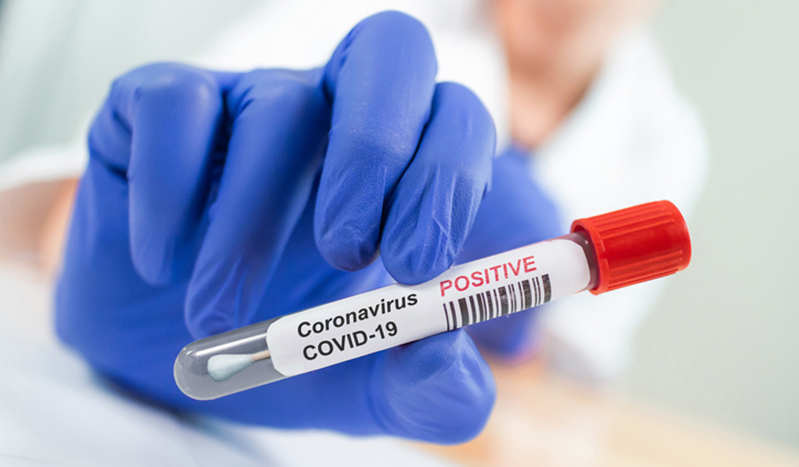 Test de detección de coronavirus, aclaramos la dudas para estar bien informados