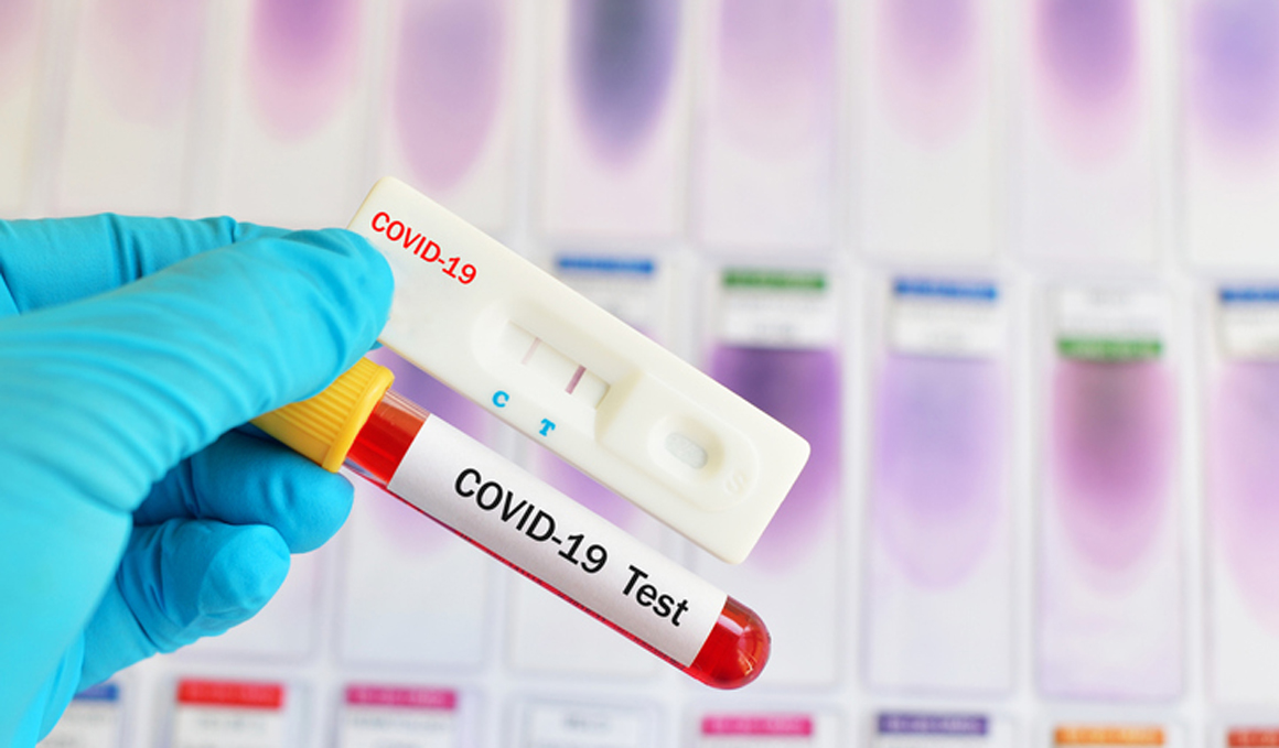 Test de detección de coronavirus, aclaramos la dudas para estar bien informados