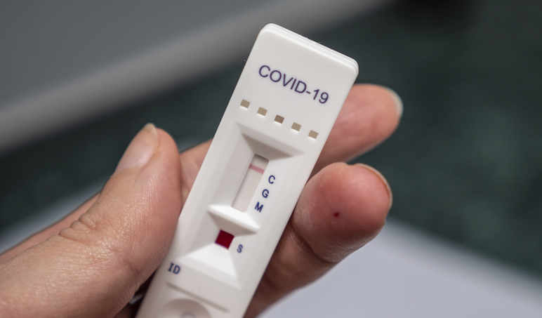 Test de detección de coronavirus, aclaramos la dudas para estar bien informados